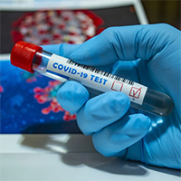 COVID-19 : dépistages gratuits à Lognes