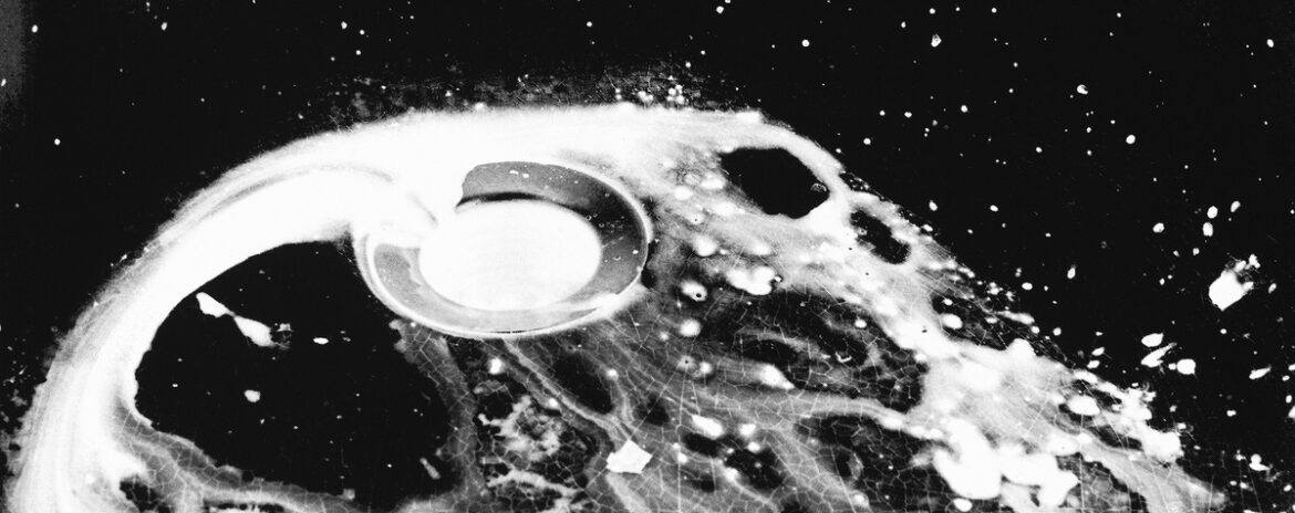 , Exposition : Laia Abril – On Mass Hysteria / Une histoire de la misogynie